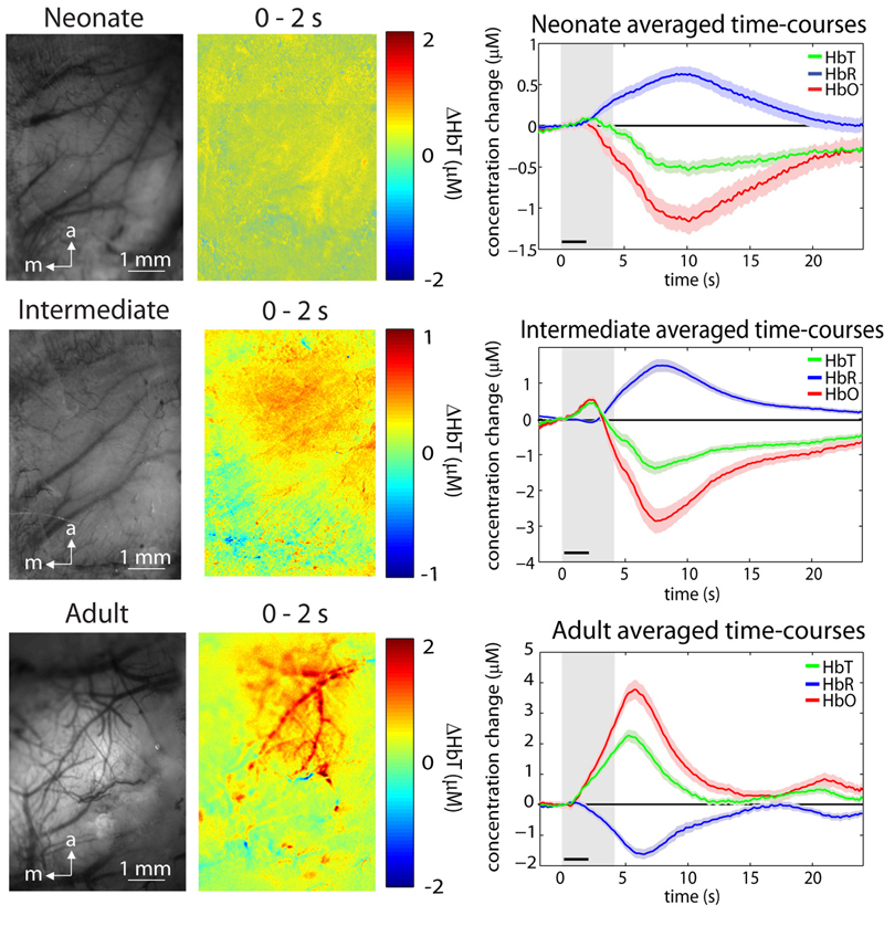 Left gray-scale MS-OISI images of cortical surface; middle: difference maps showing changes in hemoglobin concentrations. Right: hemoglobin levels over time.